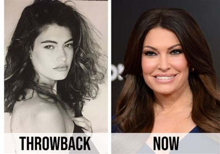 Cindy Kimberly Plastic Surgery: Cindy's Changing Appearance Followed by Artificial Procedures!