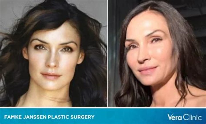 Famke Janssen Plastic Surgery: The Ultimate Guide to Her Plastic Surgery Speculations 