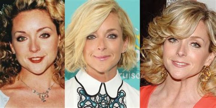 Jane Krakowski Plastic Surgery Before and After Botox Injections
