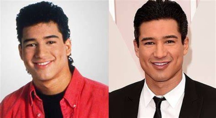 mario lopez plastic surgery